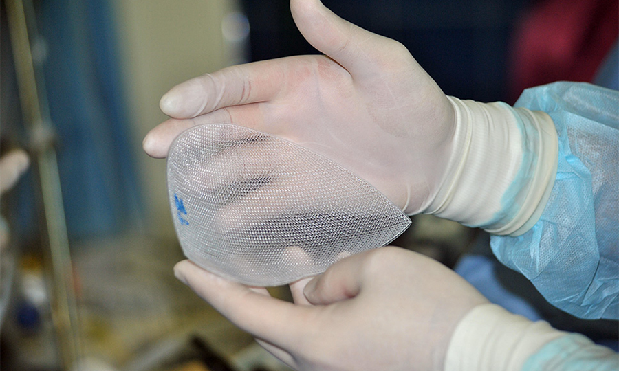 Пластика грыж с применением сетчатых имплантатов